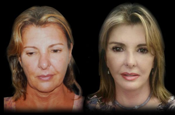 Edgar Ernesto Torres Mejía-26