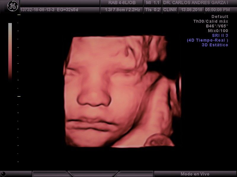 Carlos Andrés Garza Flores-1