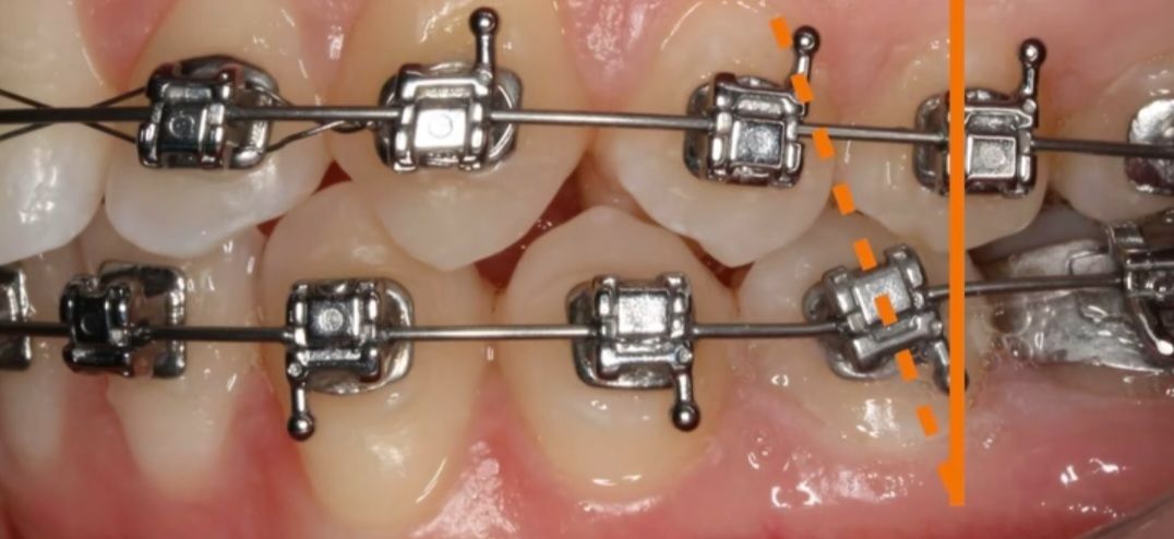 Fabiola Arcos Huesca-71