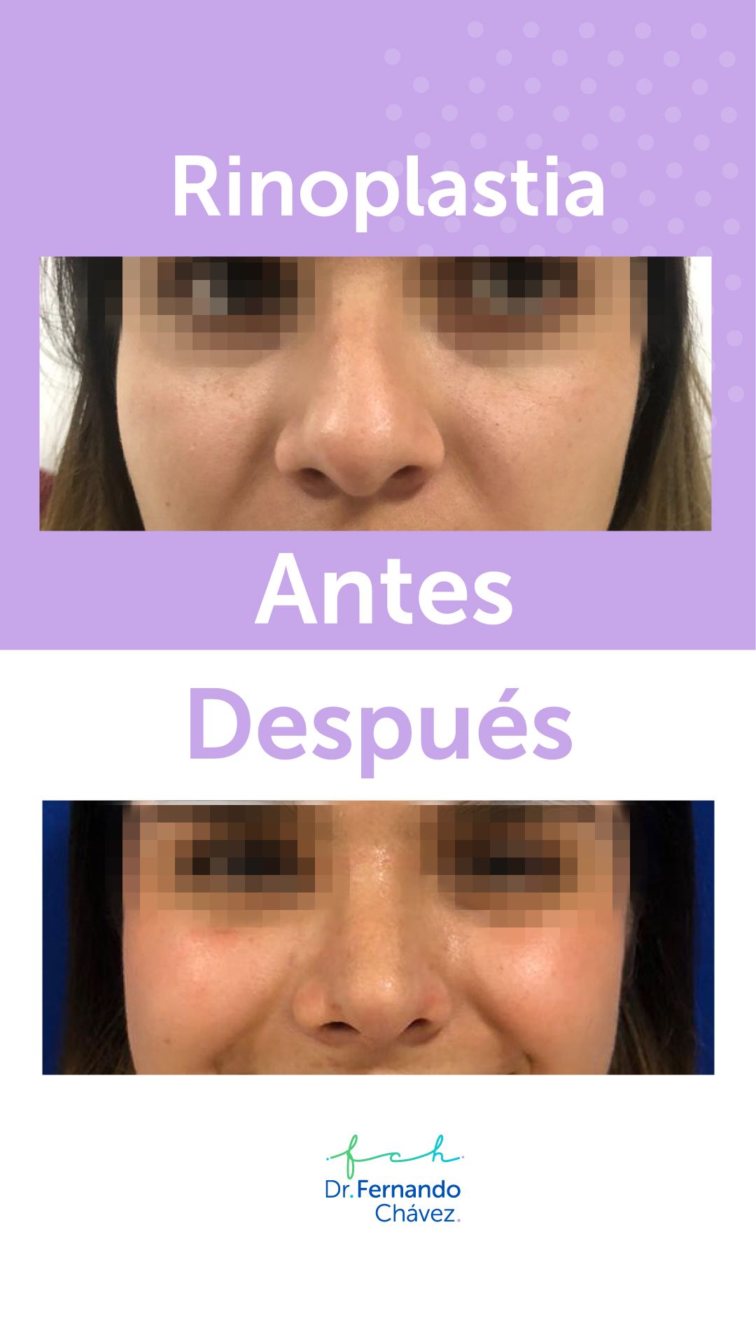 Fernando Chávez Osorio-7