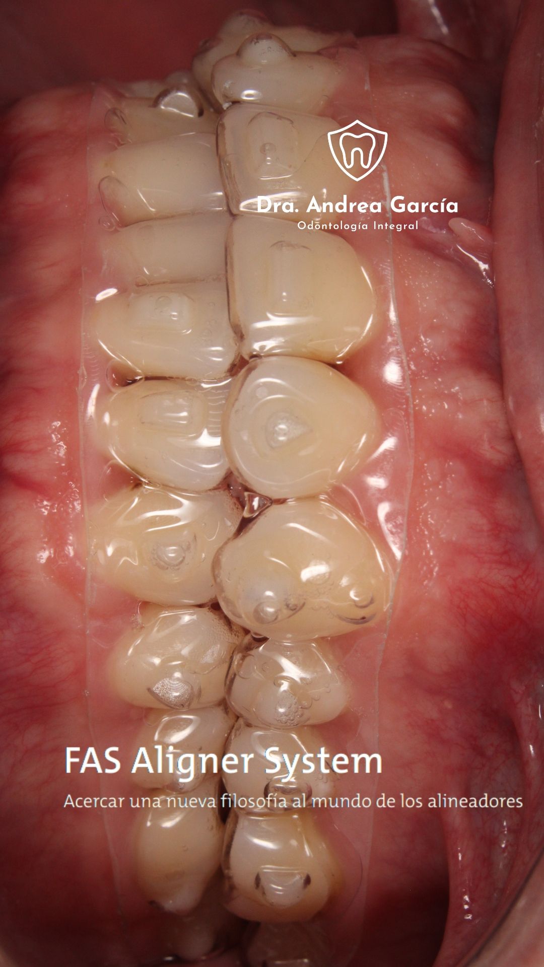 Andrea Hernández Garcia-5