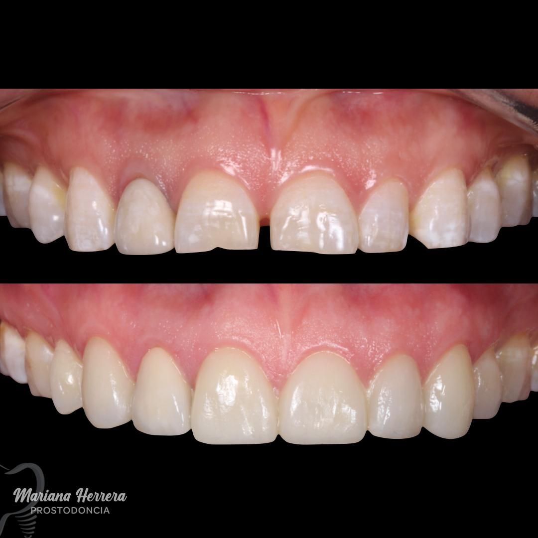 Mariana Herrera Martín Del Campo-10