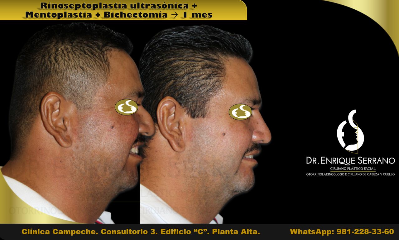 Enrique Serrano Cruz-25