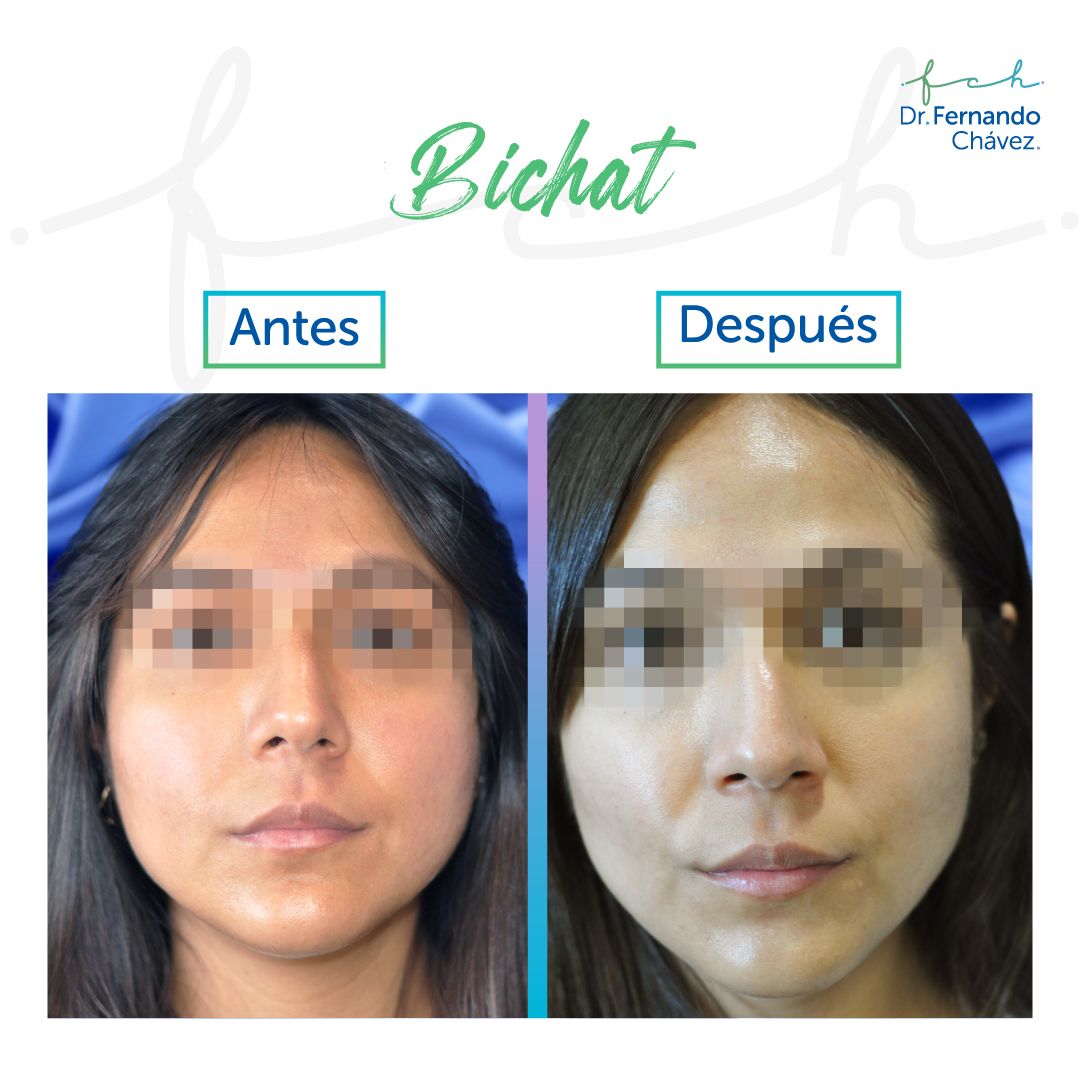 Fernando Chávez Osorio-25