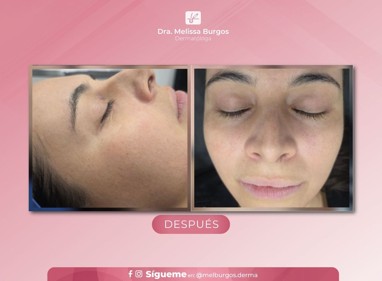 Melissa Burgos Romero-8