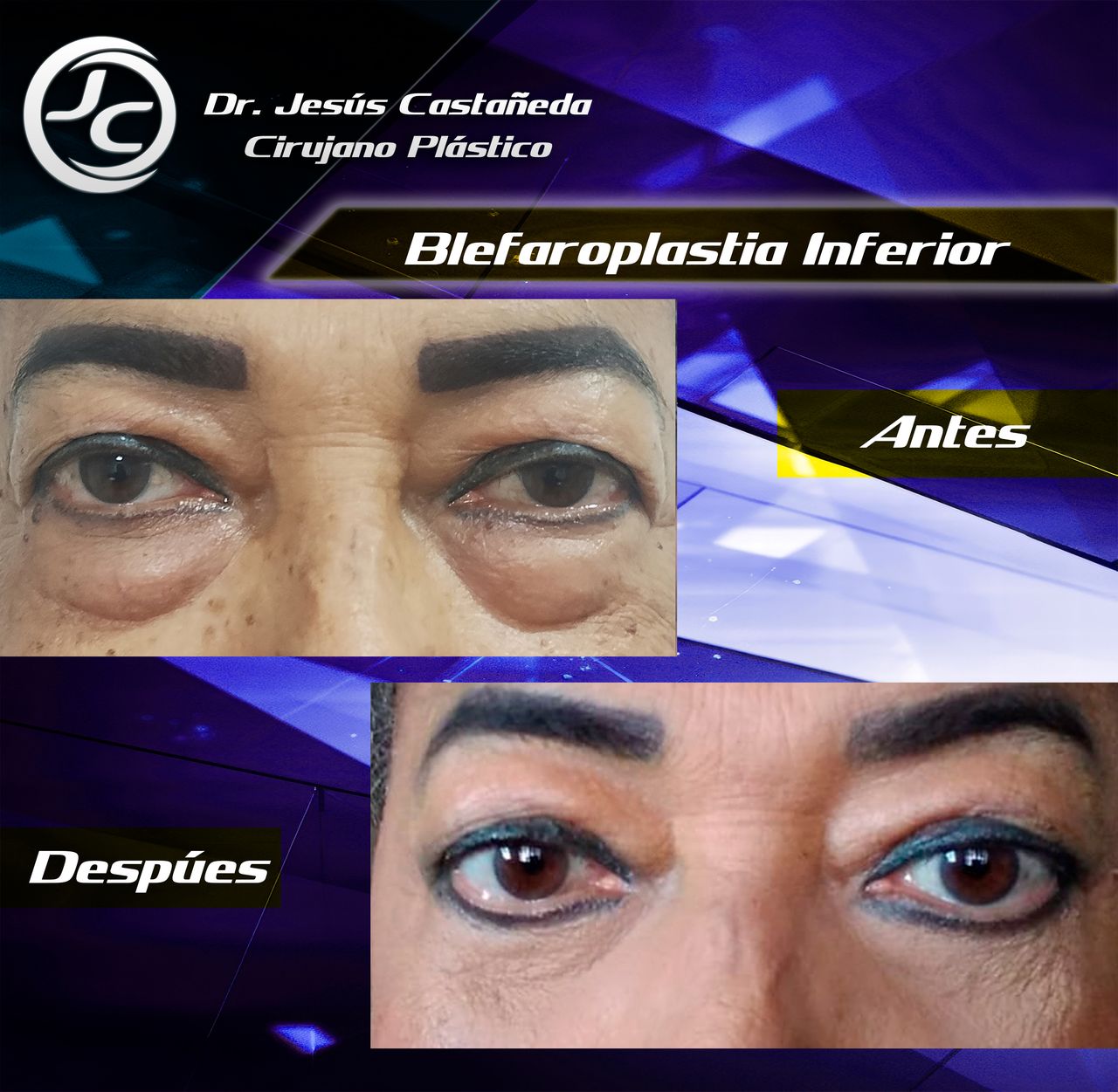 Jesús Castañeda Hernández-4