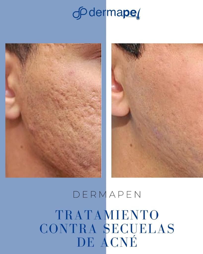 Maria De Lourdes Ascencio García-10