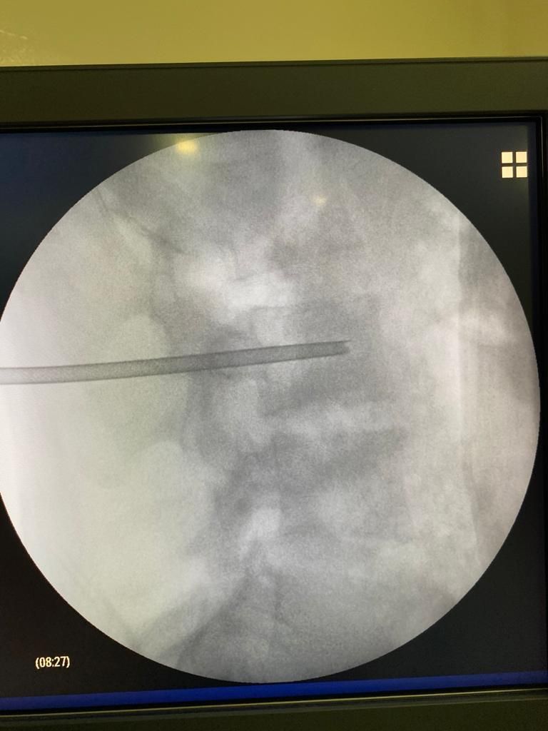 Juan José Luévano De La Cruz-30