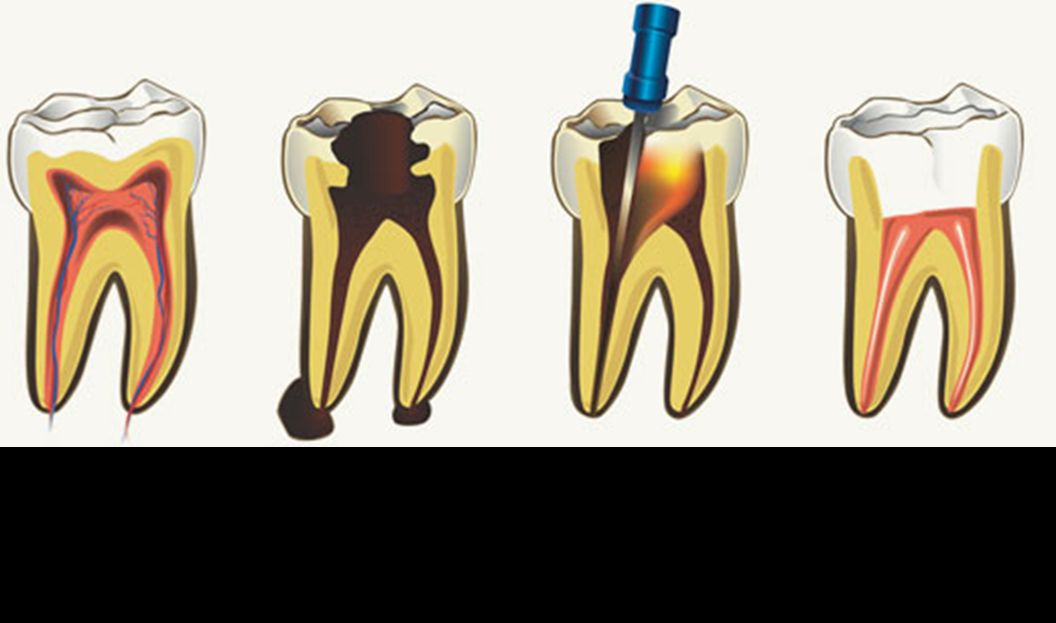 Juan Carlos Troche Chavez-16