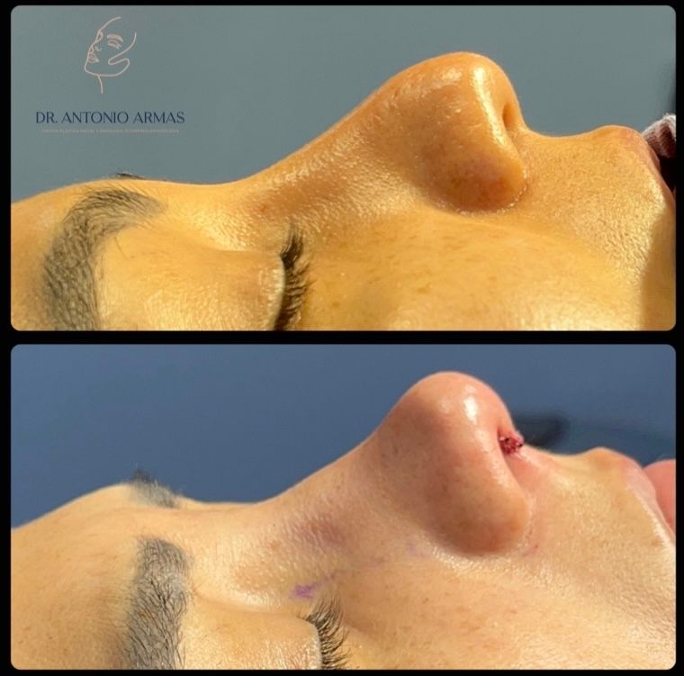 Juan Antonio González Armas-9