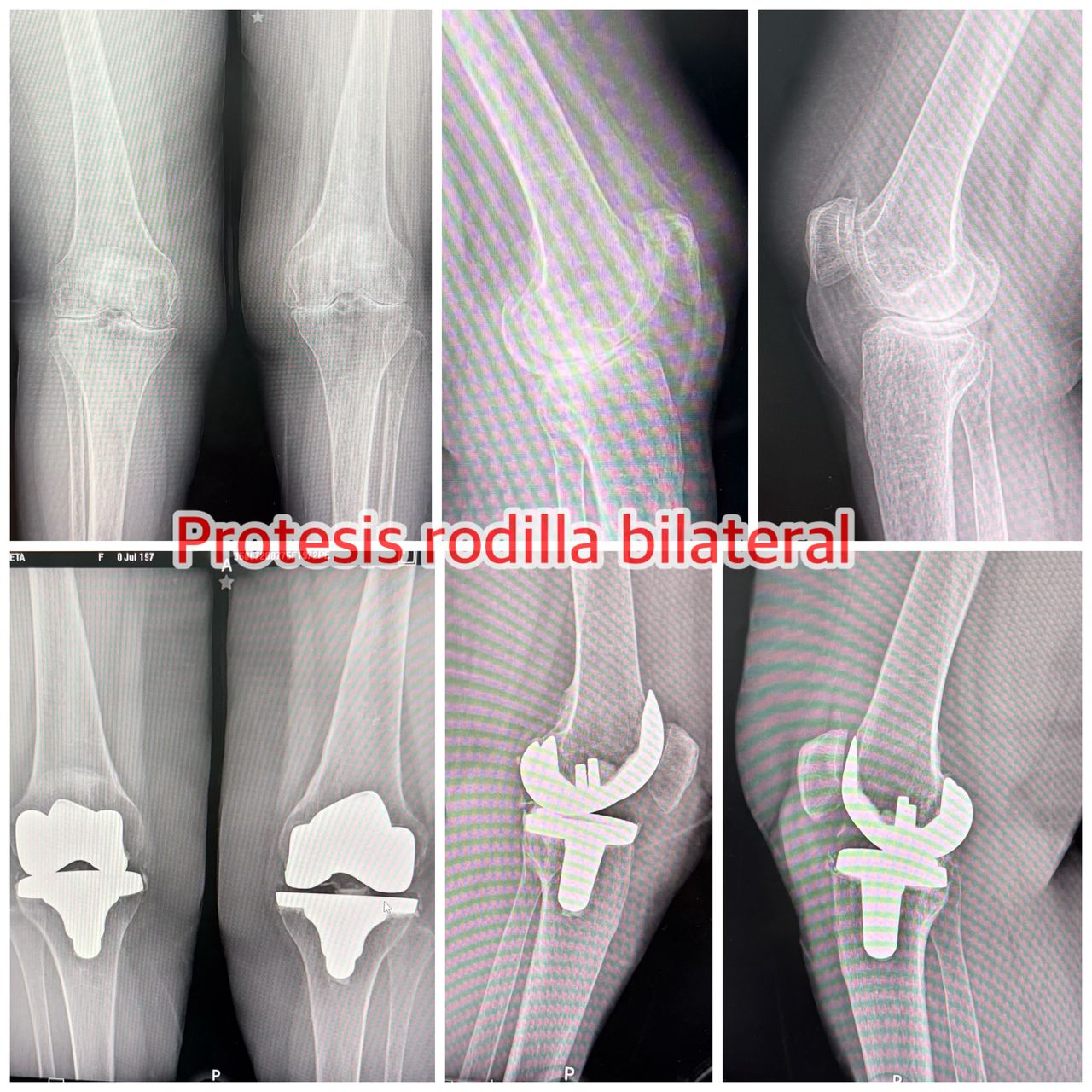 Carlos Tapia Hernández-17