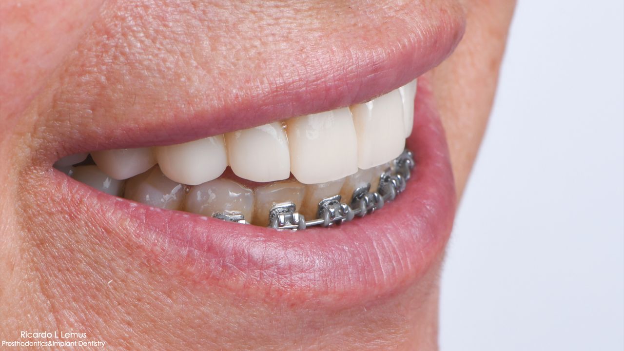 Ricardo López Lemus-7