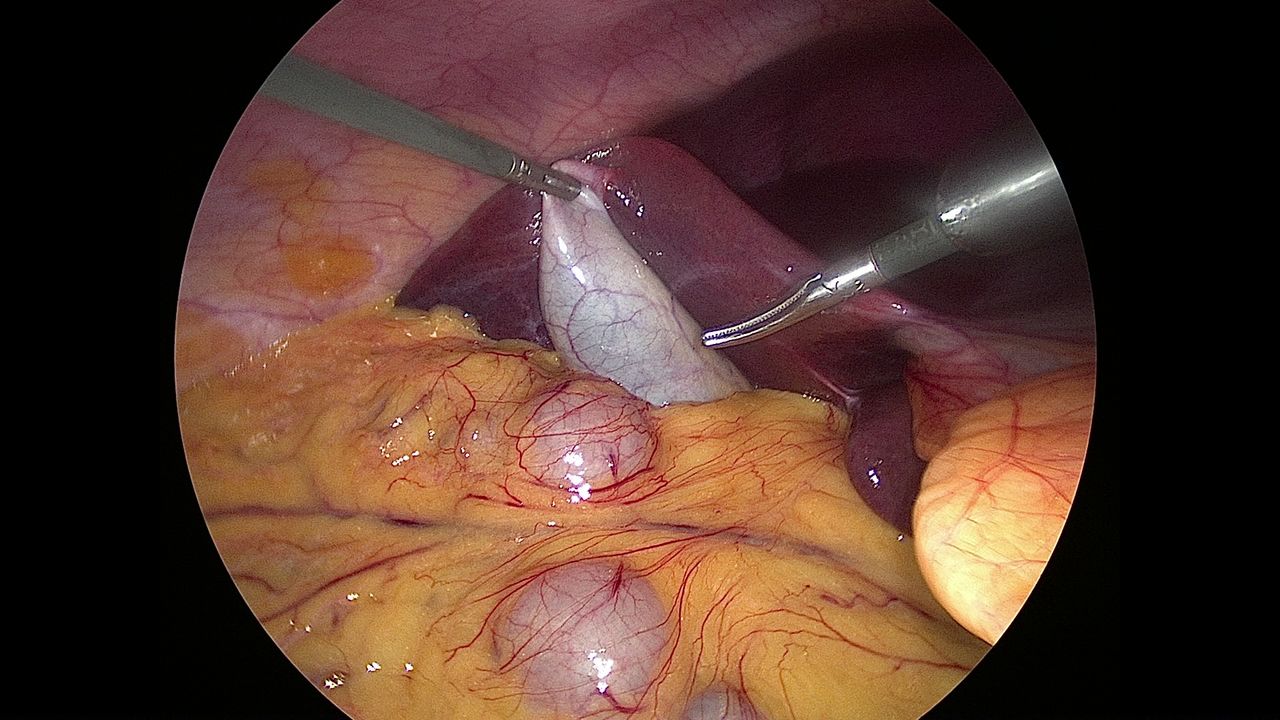 Ferstman Duran Hernandez-6