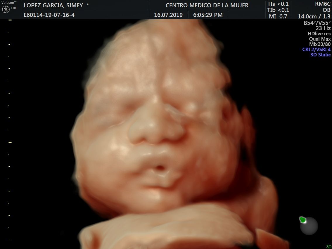 Julio Cesar Monárrez Martín-15