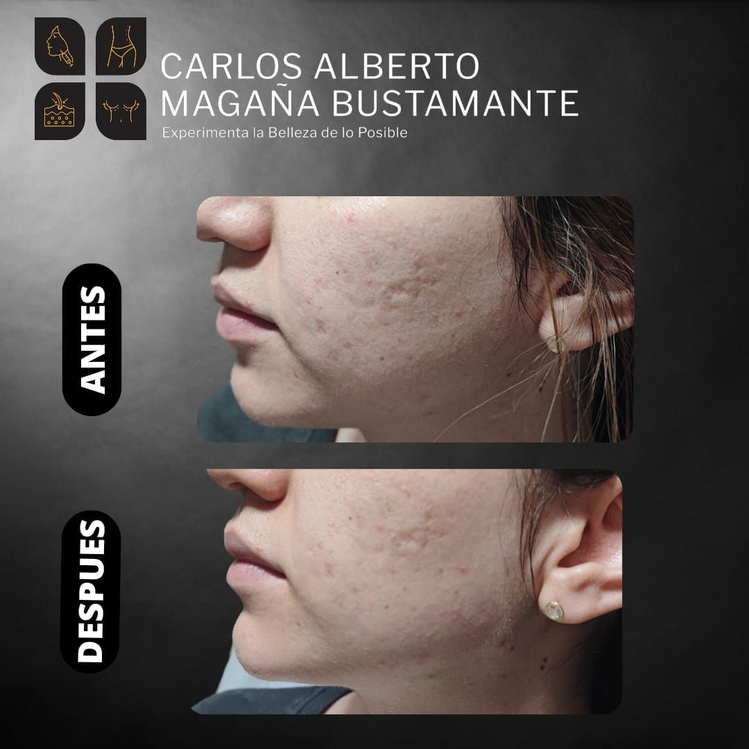 Carlos Alberto Magaña Bustamante-47