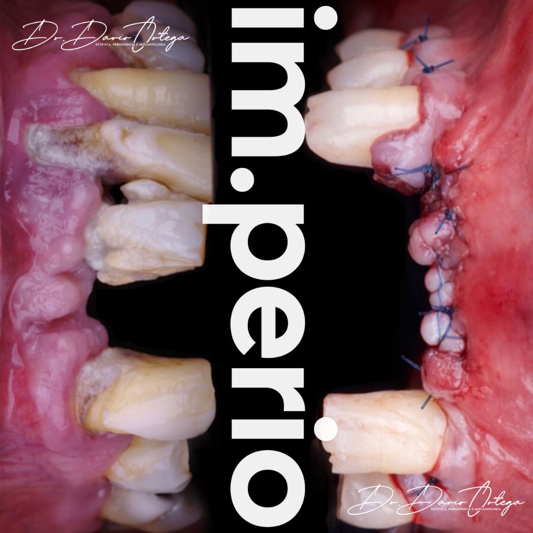 Dario Ortega Aceves-34