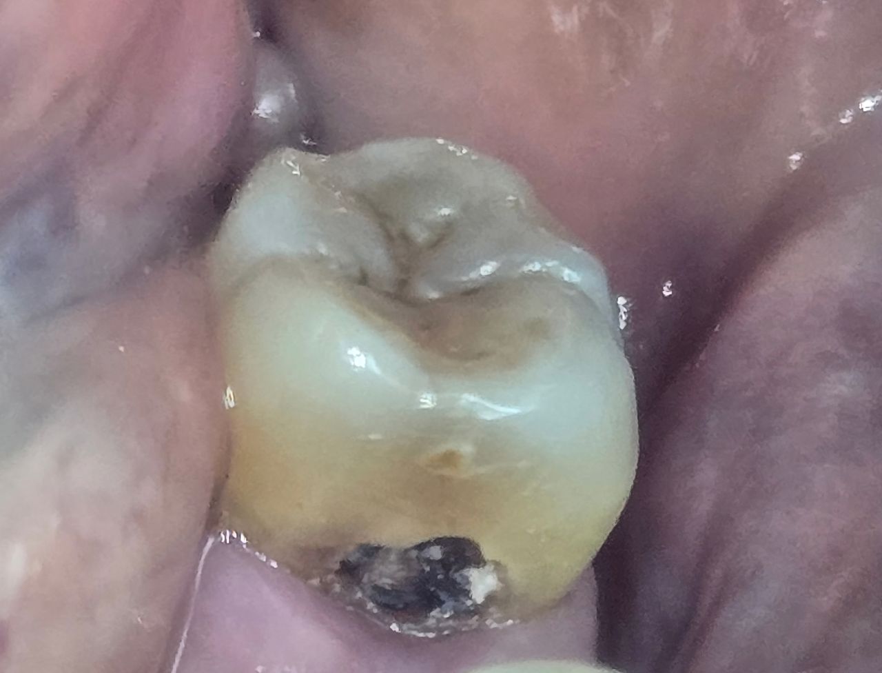 Edgardo Caballero Dávila-23