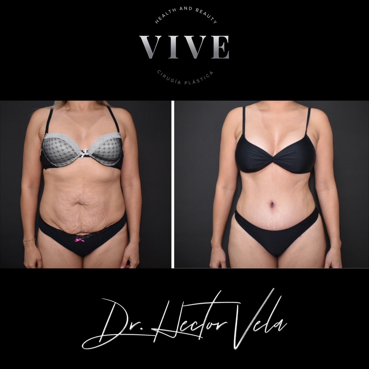 Héctor Eduardo Vela Cardona-148