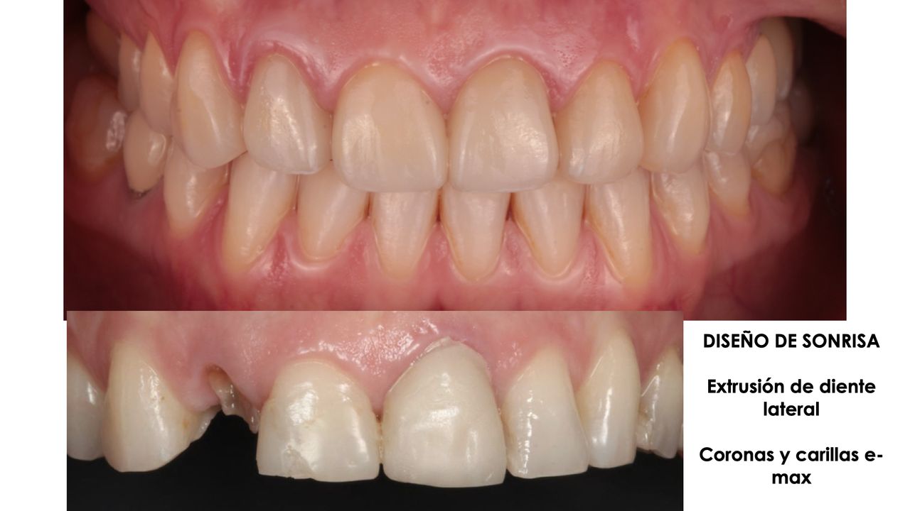 Andrea Cervantes Urenda-11