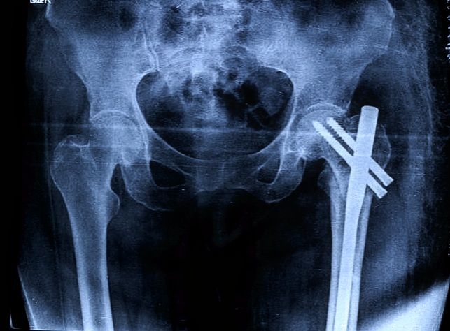 Cesar Daniel Maldonado Cortez-13