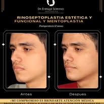 Enrique Serrano Cruz-14