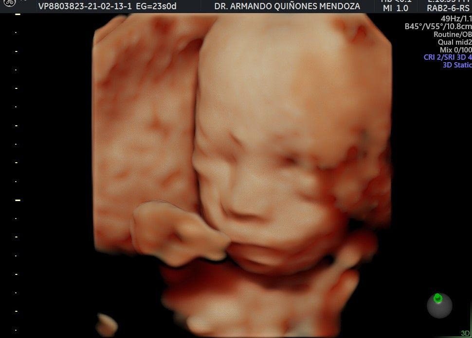 Armando Quiñones Mendoza-13