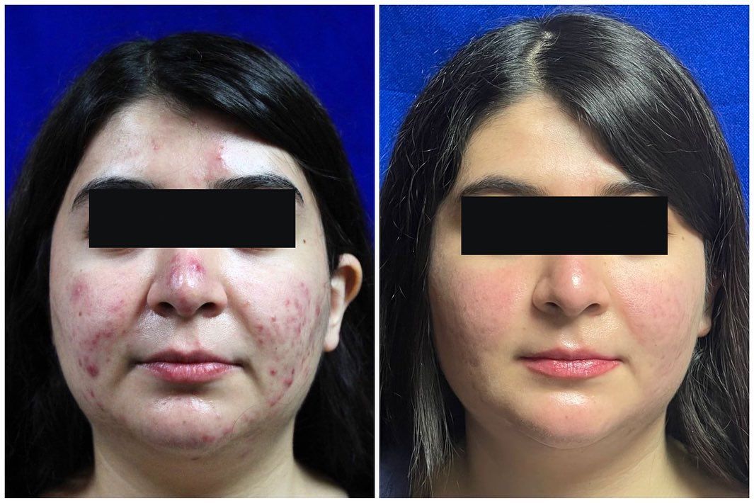 Adrián Martínez Moreno-11