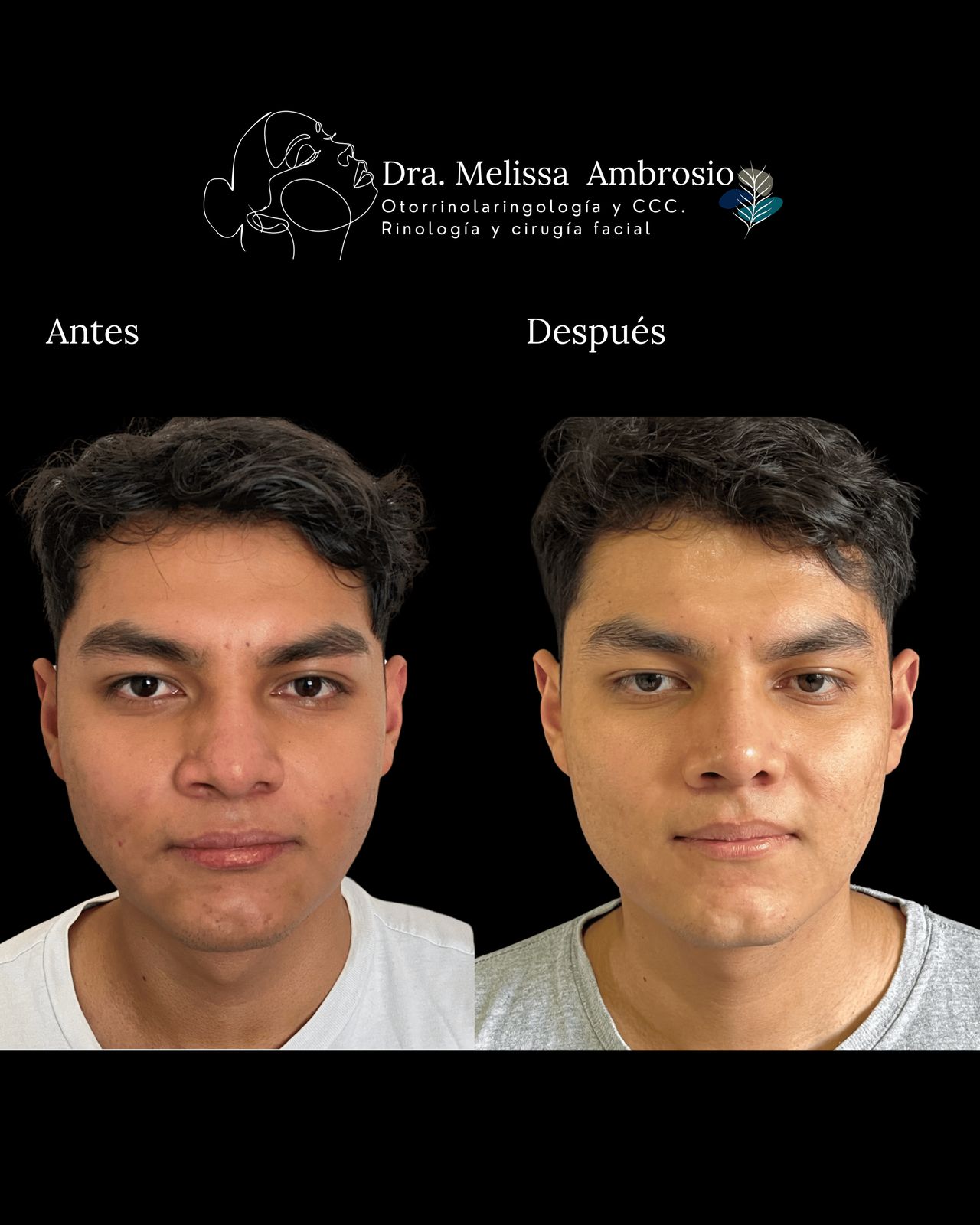 Melissa Guadalupe Ambrosio Mendoza-3