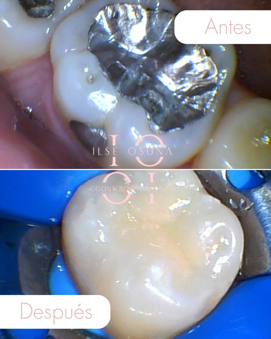 Ilse Valeria Osuna Rodríguez-15