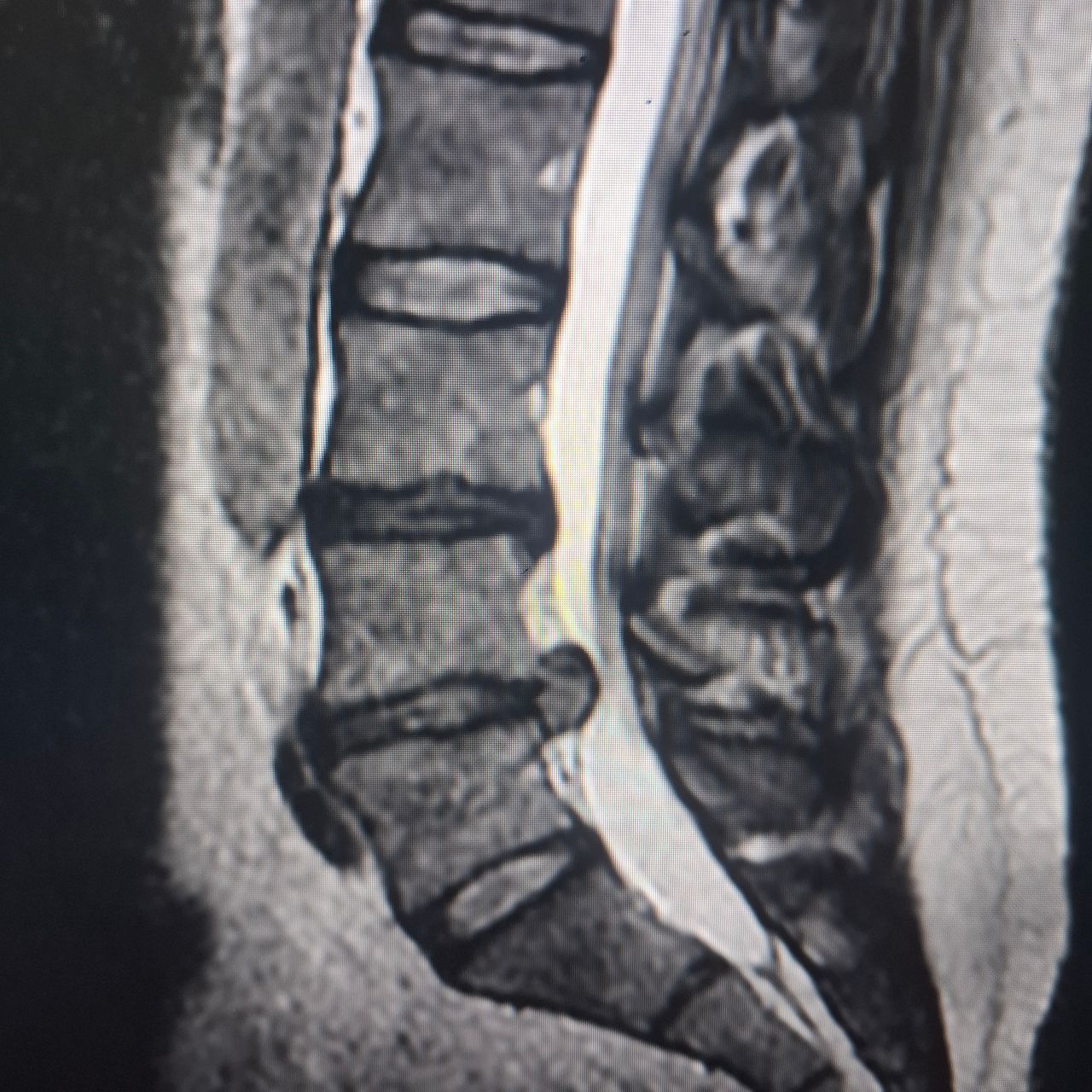 Carlos Eduardo Chairez Leyva-4