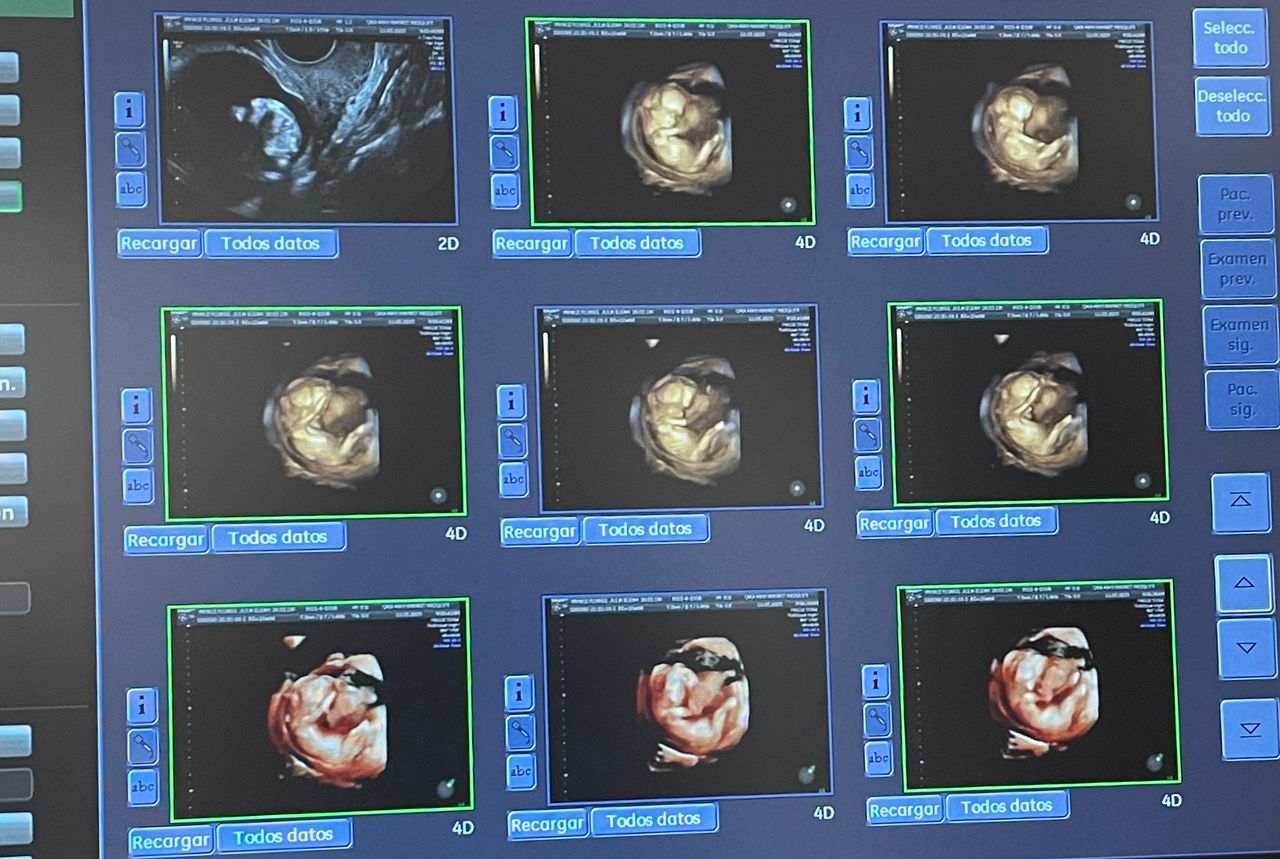 Mayi Mayret Mesquiti-2