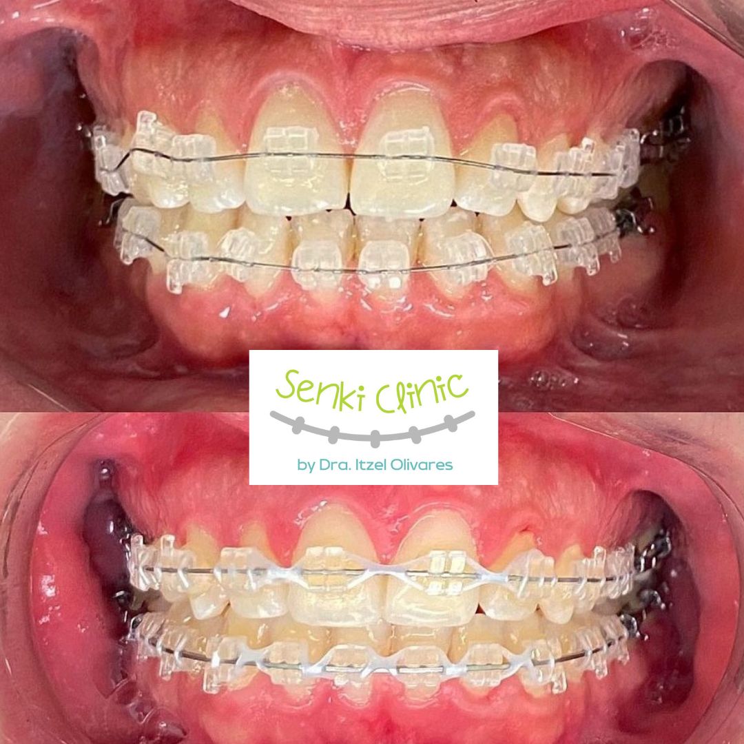 Itzel Olivares Lara-16