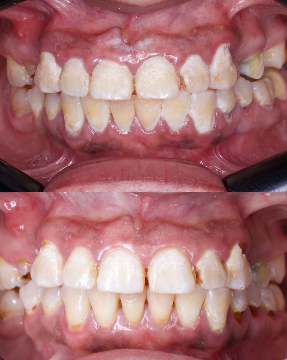 Francisco Galeana Araujo-1