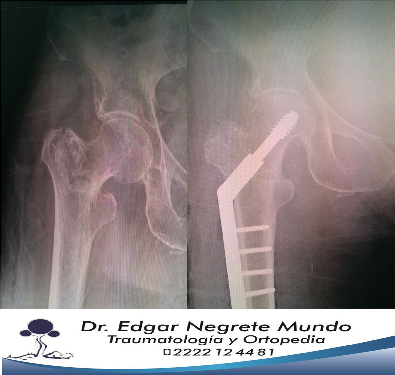 Edgar Negrete Mundo-4