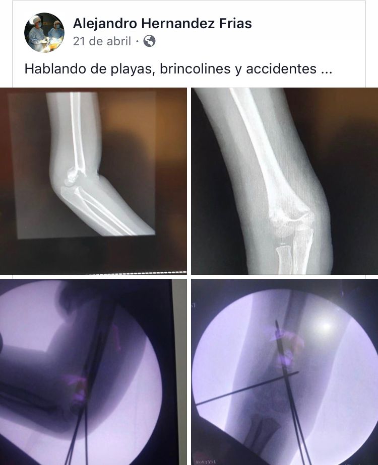 Alejandro Hernandez Frias-10