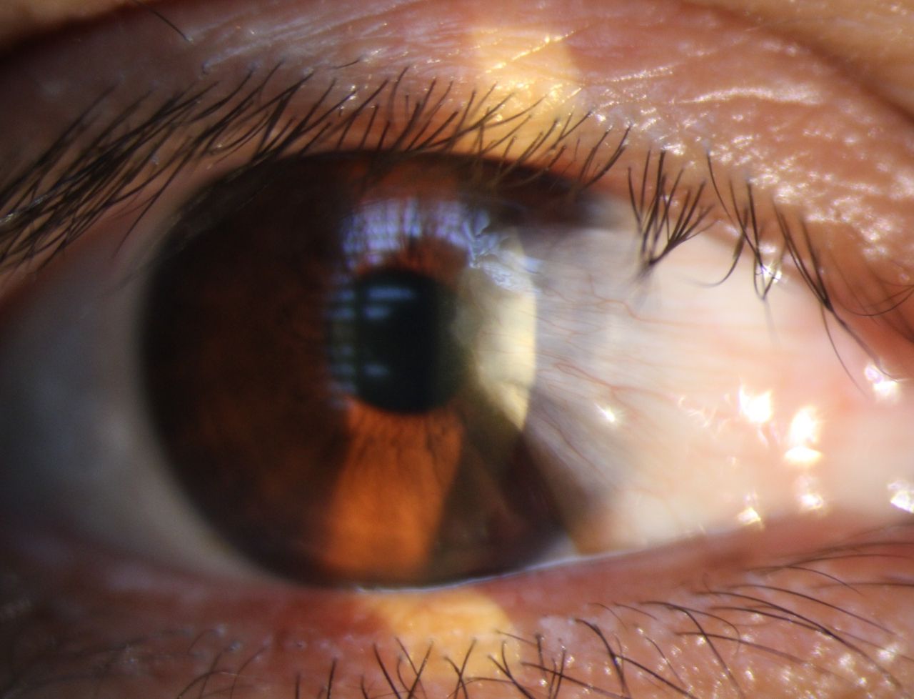 Kalid Barush Hernández Diaz-1