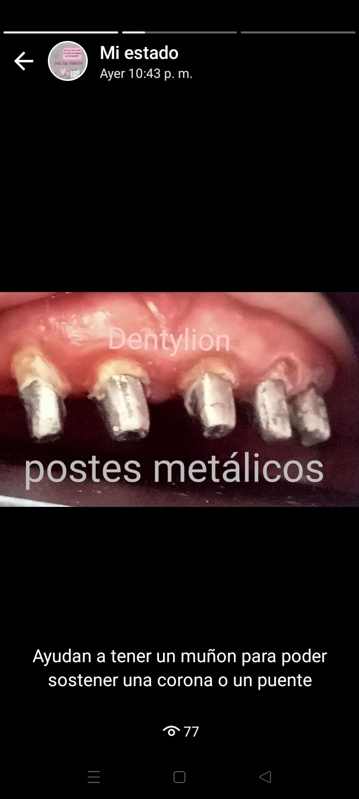 Jessica De La Barrera Valladolid-7