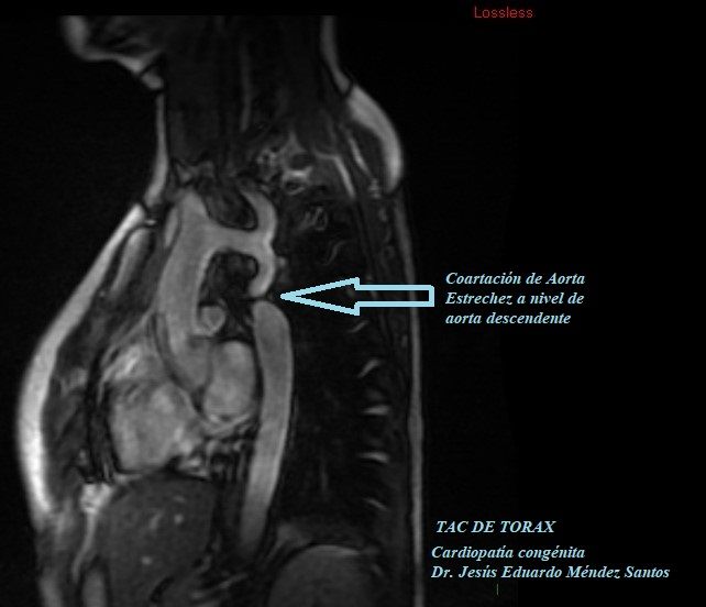 Jesus Eduardo Méndez Santos-0
