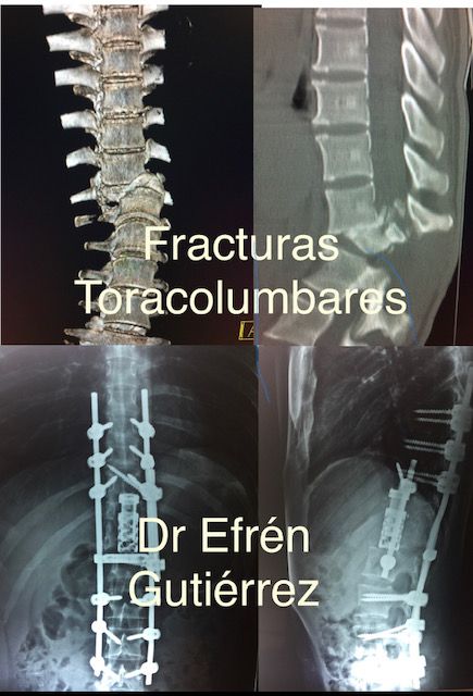 A. Efrén Gutiérrez Bautista-1