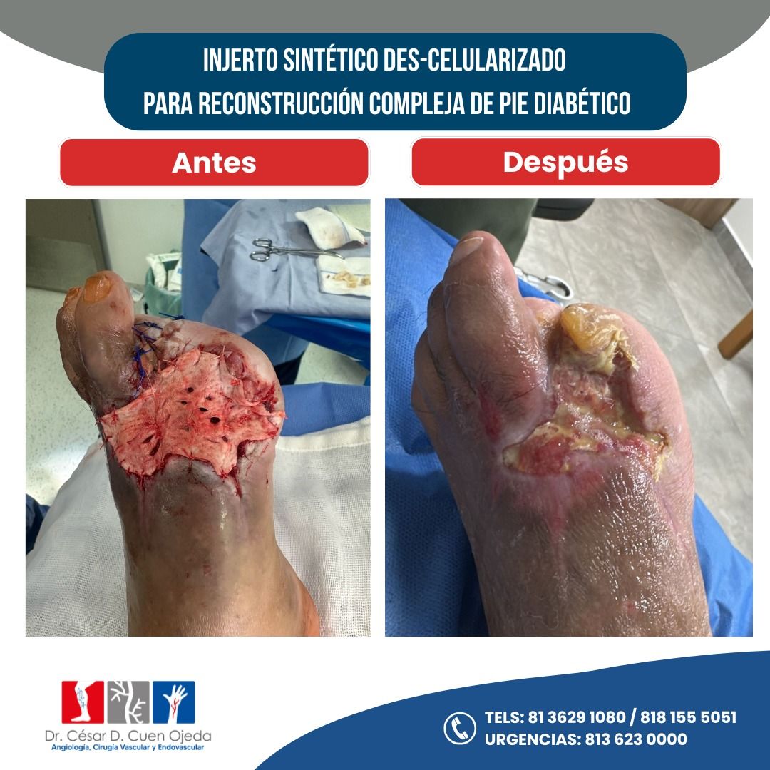 César Daniel Cuen Ojeda-5