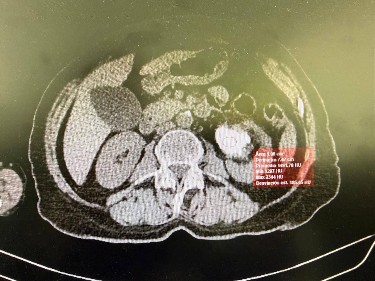 David Ramírez Ramírez-20