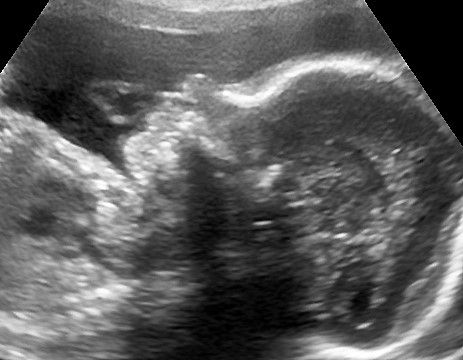 Manuel Pérez Morales-17