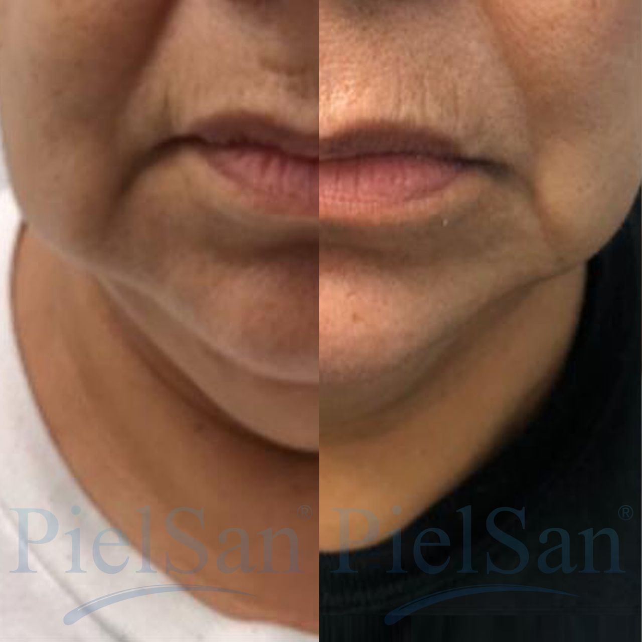 Araceli Medina García-3