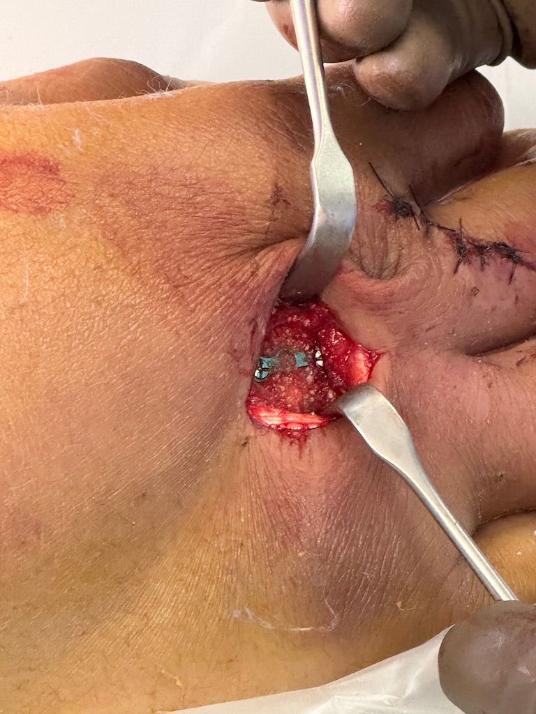 Gisela Cleto Zepeda-148