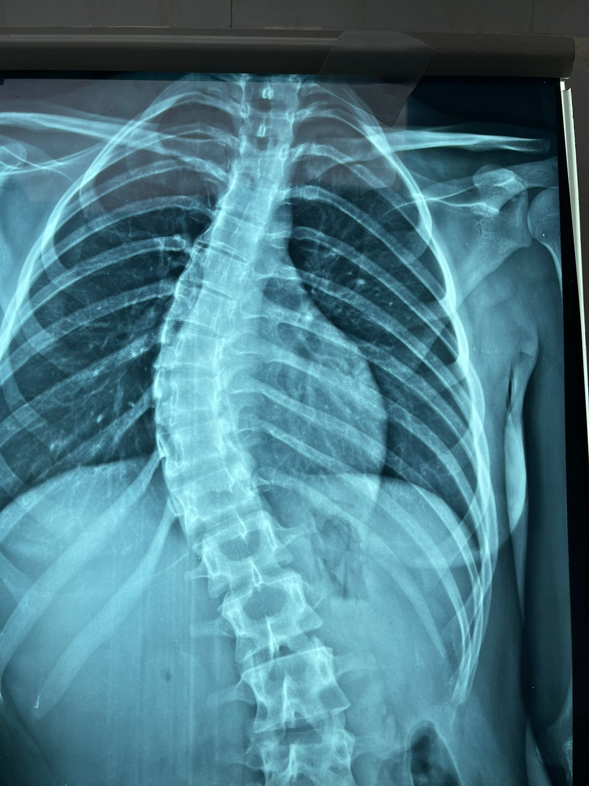 Carlos Tariacuri Valencia Aviles-17