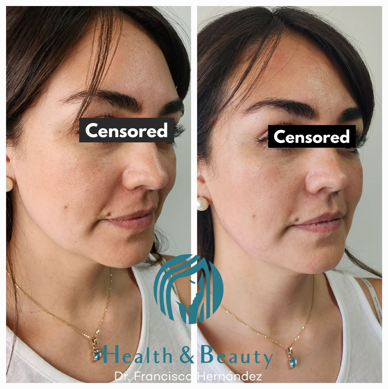 Francisco Hernández Gómez Crespo-30