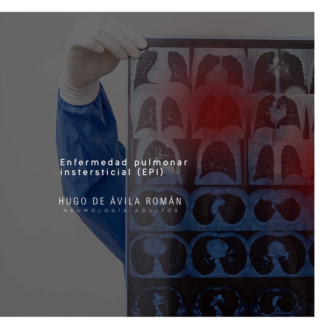 Hugo De Ávila Román-5