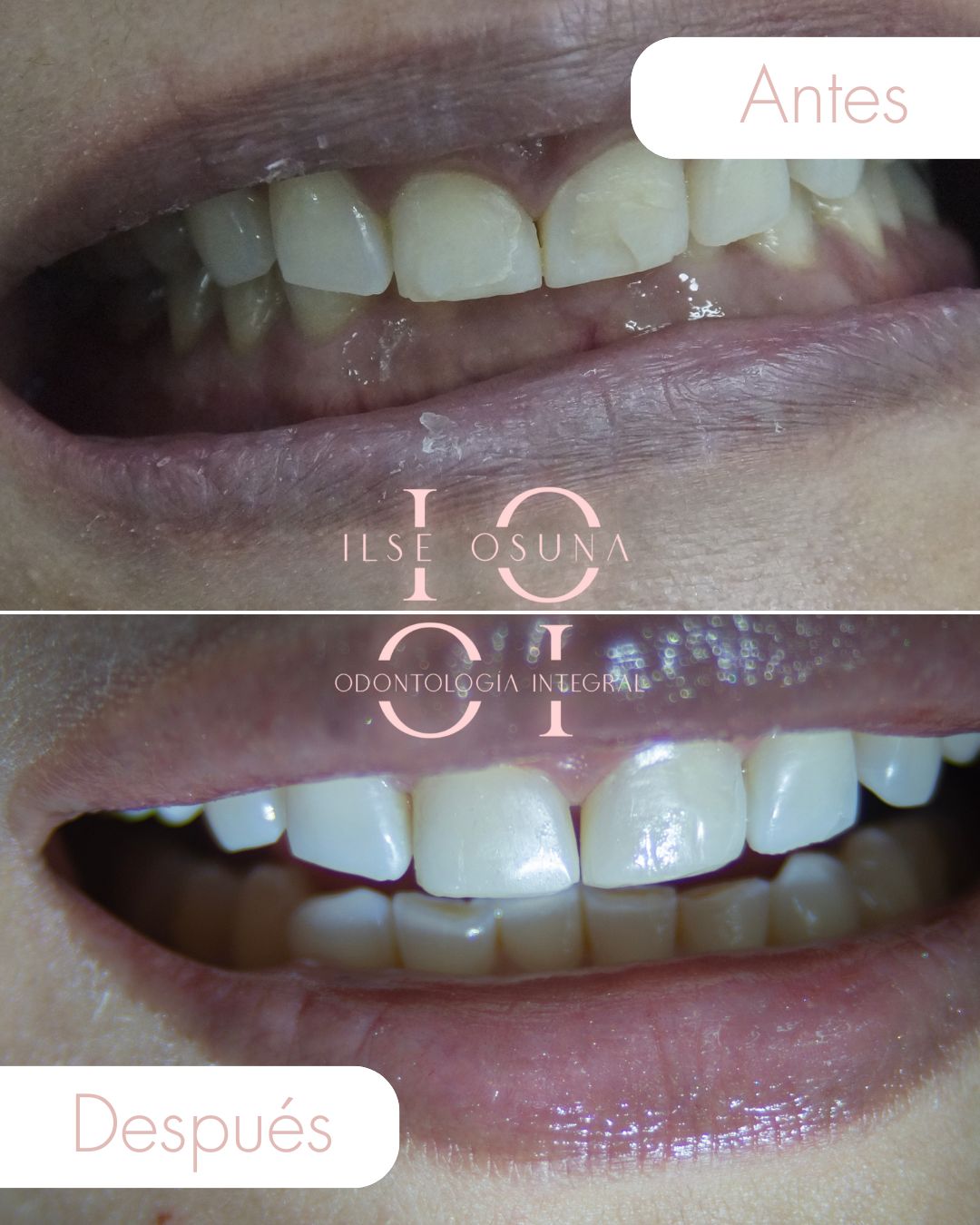 Ilse Valeria Osuna Rodríguez-9