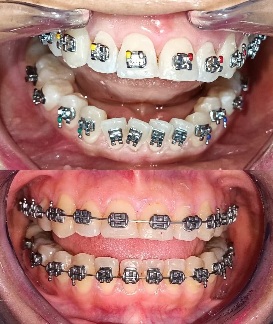 Luz Anel Valente Lozano-0