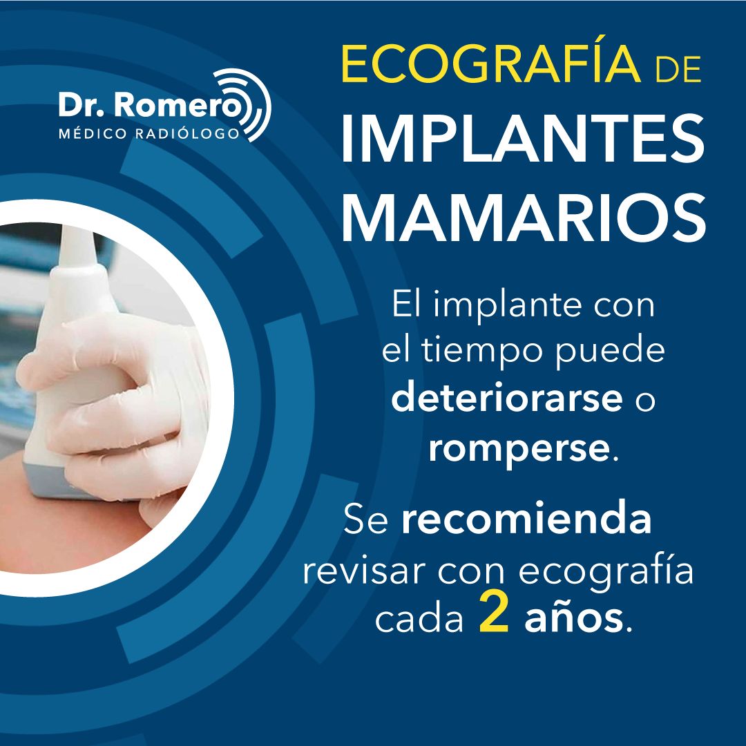 Jorge Romero Moreno-1